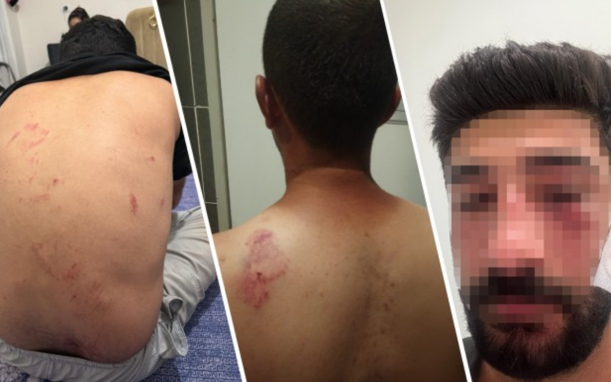 İHD’den ‘ırkçılık körükleniyor’ tepkisi