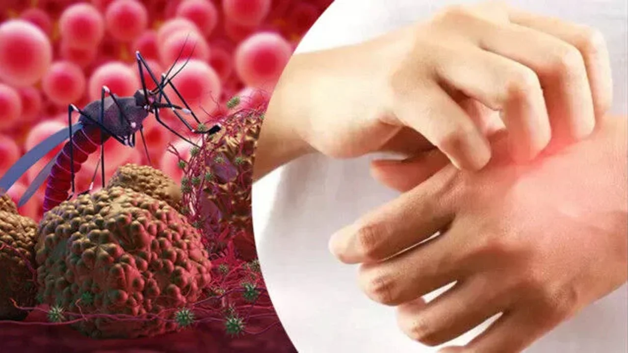 Bebekler için ilk sıtma tedavisi onaylandı