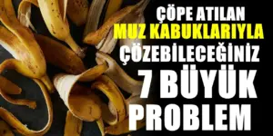 Muz kabuklarını çöpe atmayın: Evde 7 farklı şekilde değerlendirebilirsiniz